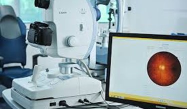 Femtosecond laser - kreiranje preklopca kod skidanja dioptrije